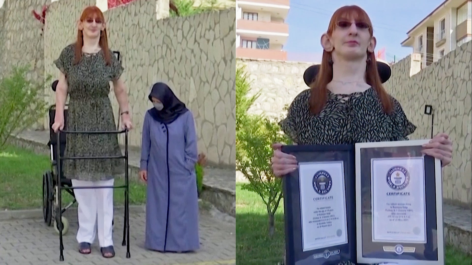 Rumeysa Gelgi: The world's tallest woman stands more than 7 feet