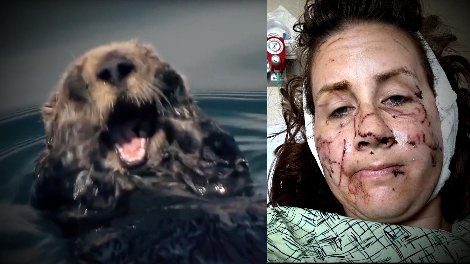 Three-legged dog battling cancer rescues otter from river - CBS News