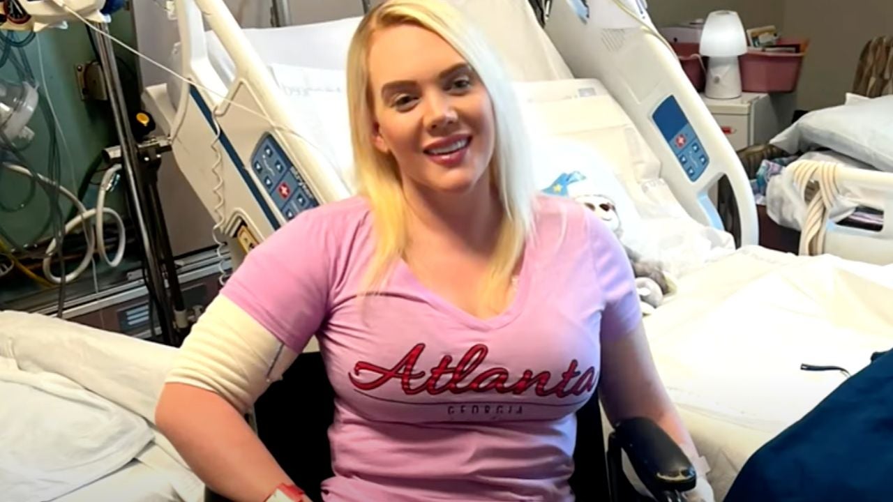 California mum has her arms and legs amputated after eating