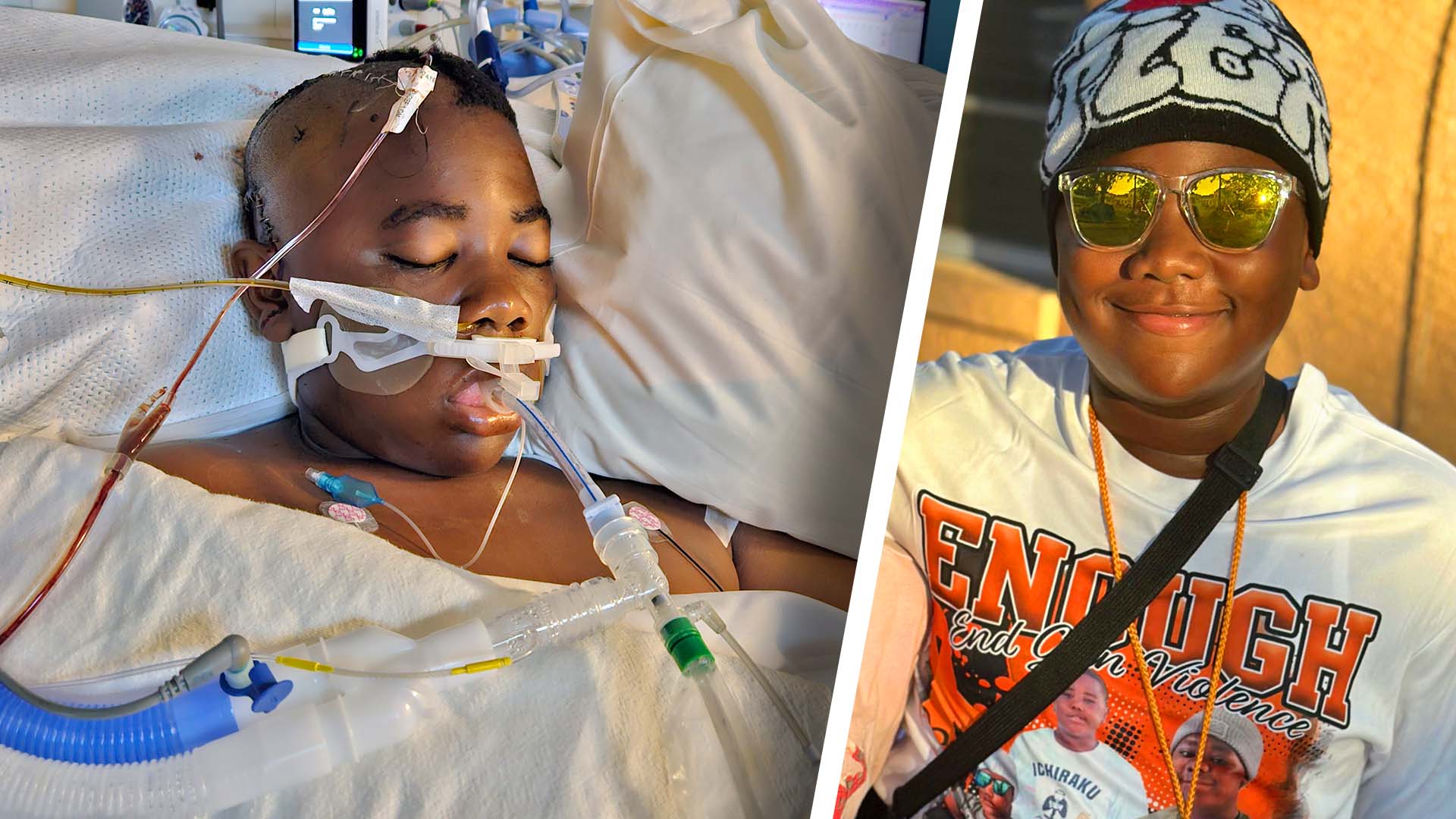 4-year-old recovering after being hit in head with baseball