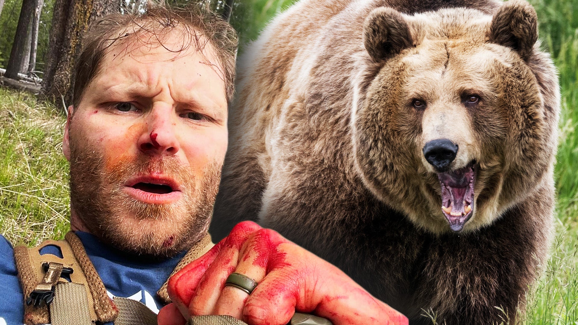 Man attacked by bear, grizzly bear