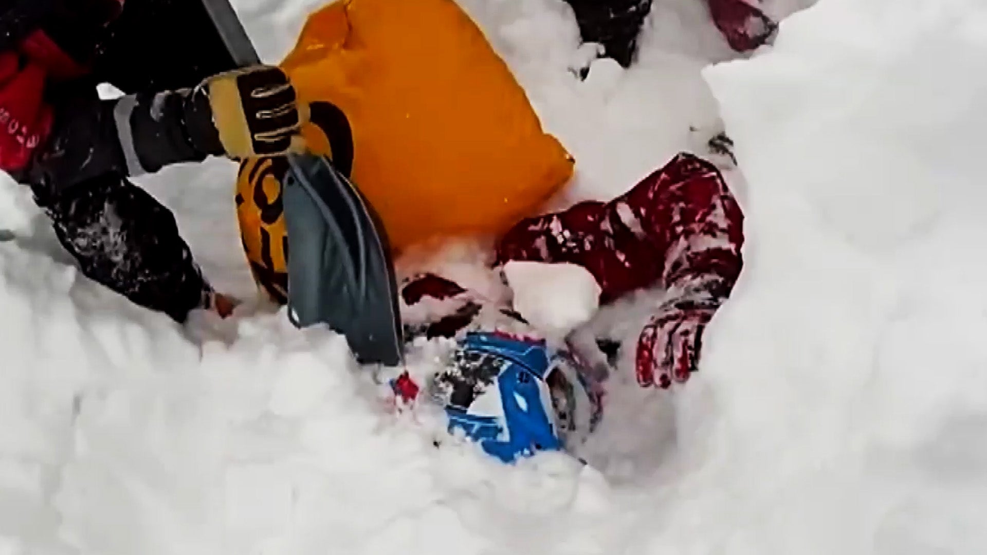 Man is shoveled out after being buried alive by an avalanche