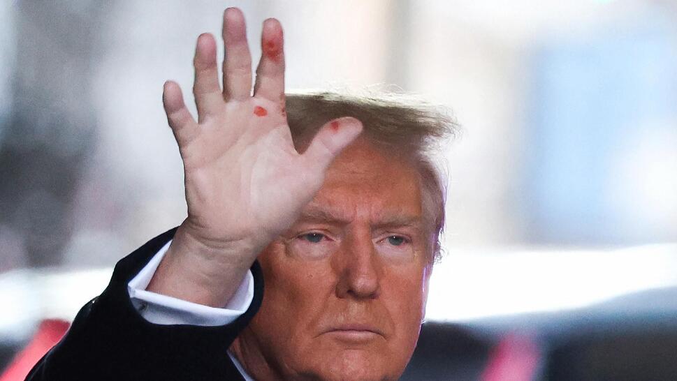 Mysterious Red Marks on Donald Trump's Hand