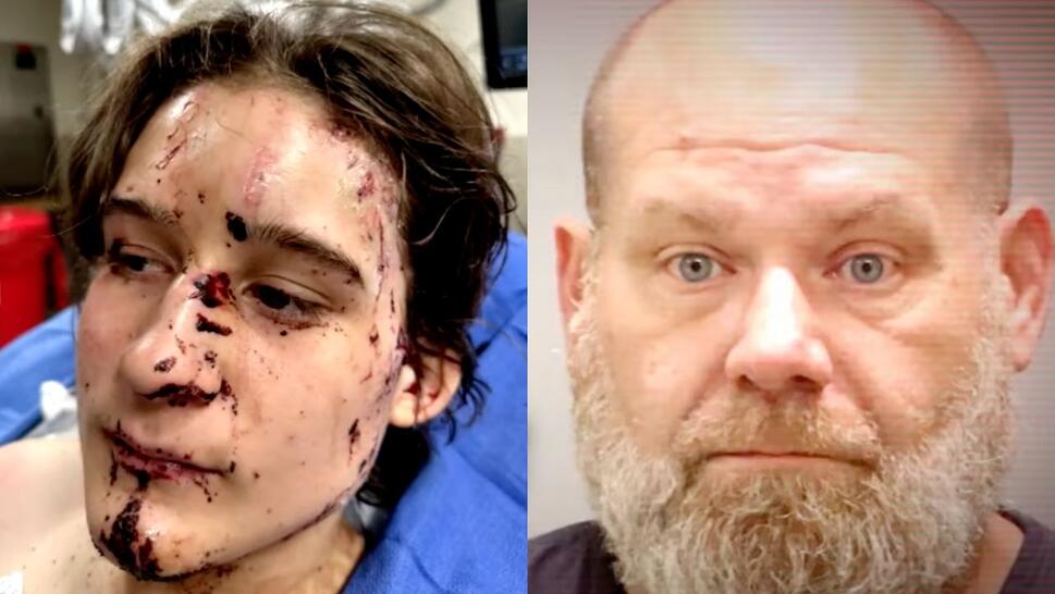 Split image. On left: Lachlan Nicol after crash. On right: Peter Swing mugshot