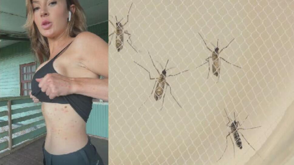 Rosie Moore showing rash on left image, mosquitos on right image