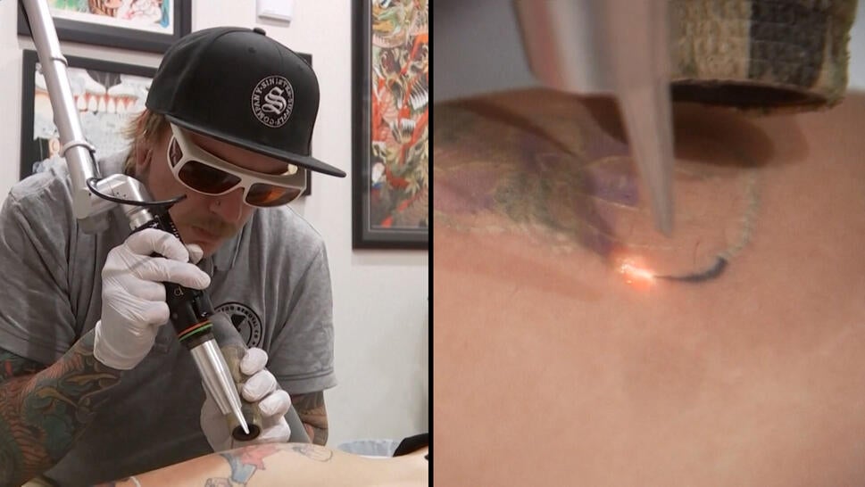 Professionals Warn Against Using At-Home Tattoo Kits