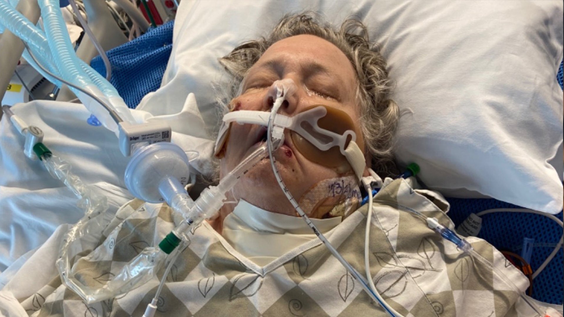 Woman About To Be Taken Off Life Support Wakes Up From Coma Inside Edition