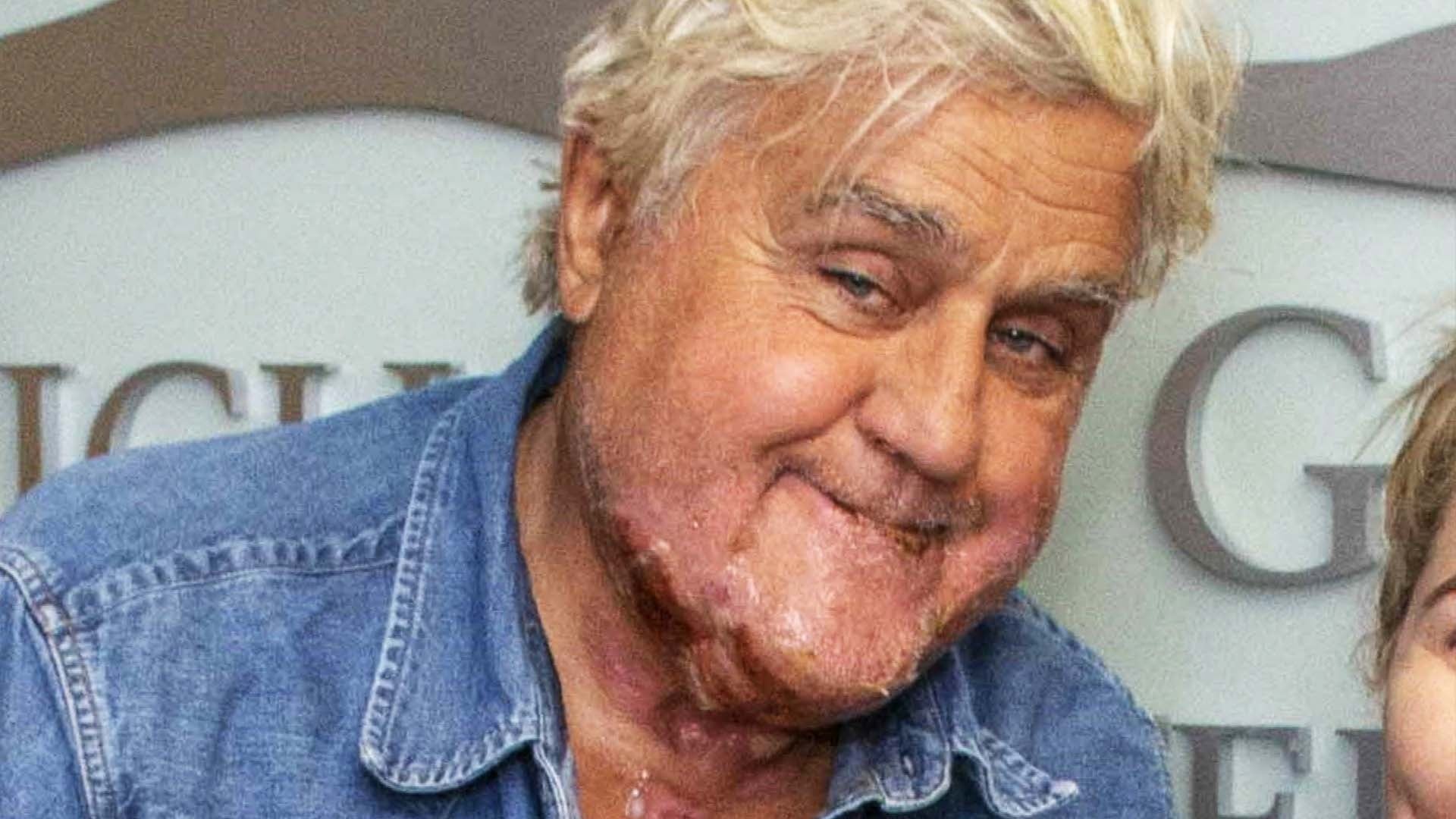 New Photo Reveals Jay Leno’s Car Fire Burns | Inside Edition